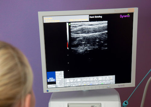 Echografie bij Fysio Henk Scholing