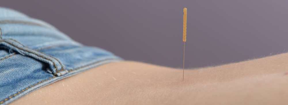Dry Needling Henk Scholing